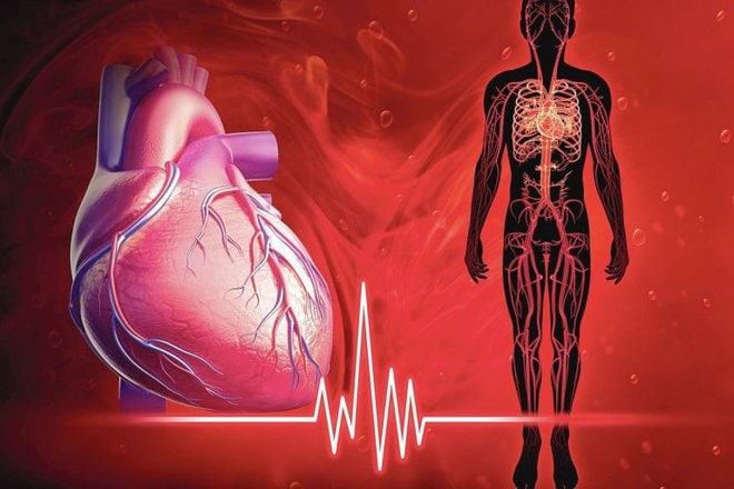 Kas yra kraujotakos sutrikimai 3 Kas yra kraujotakos sutrikimai