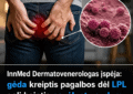 InnMed Dermatovenerologas įspėja: gėda kreiptis pagalbos dėl LPL gali baigtis pavėluotu gydymu ir sunkiomis pasekmėmis