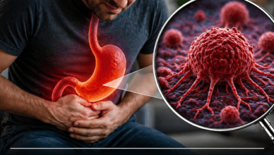 Paveikslėlyje matomas žmogus, kuris jaučia skrandžio skausmą, ir mikroskopu parodytas vėžinių ląstelių vaizdas, susijęs su skrandžio sveikata ir galimomis rimtomis problemomis.