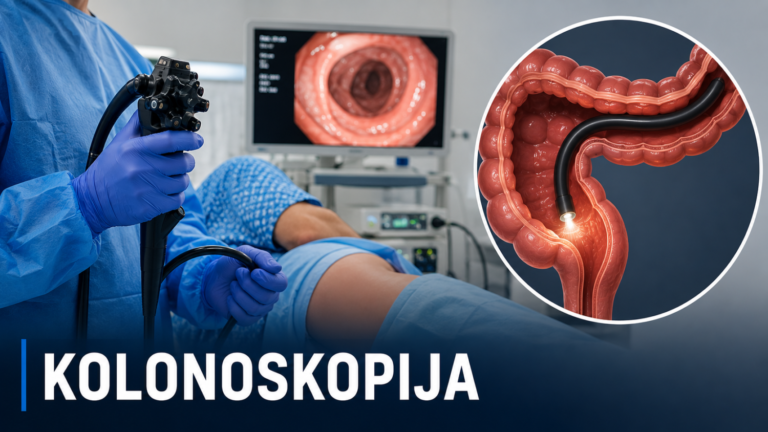 Kolonoskopija 3 Kolonoskopija