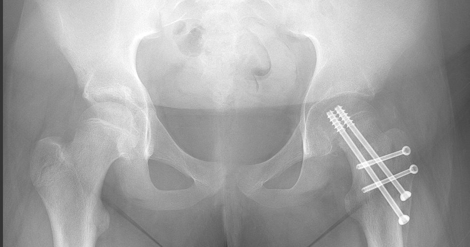 santaros klinikose vaikui pirma karta atlikta sudetinga operacija